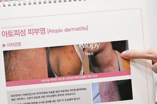 생기한의원 아토피 페이지에서 살펴보는 성인 아토피 악화 요인